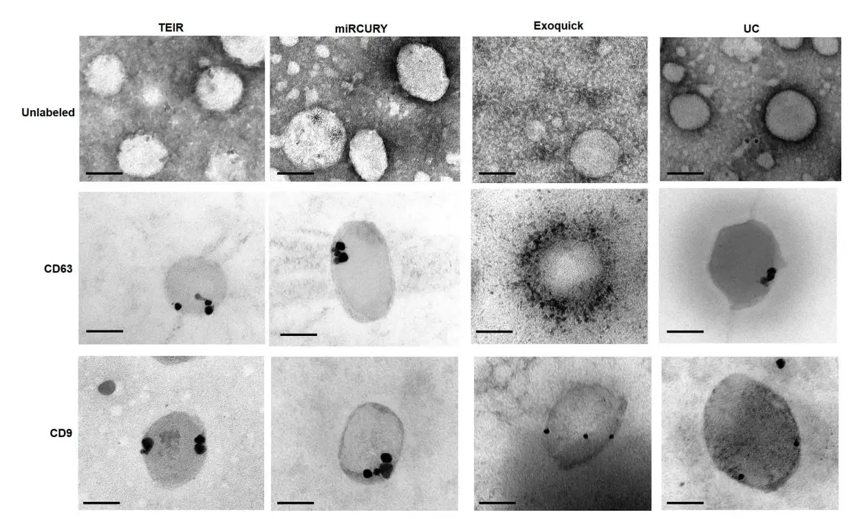 Imágenes de microscopía electrónica de transmisión mostrando exosomas con marcación de oro para CD63 y CD9